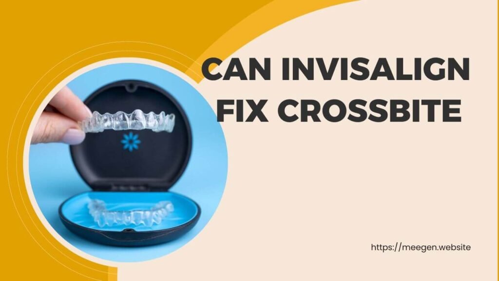 Can invisalign fix crossbite 