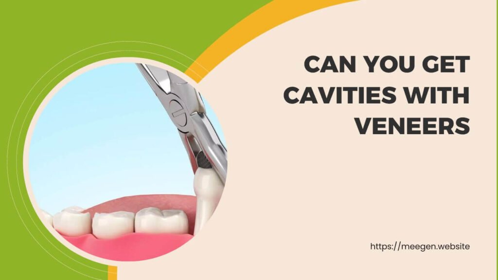 Can you get cavities with veneers