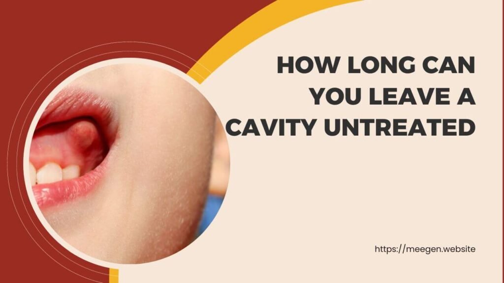 How long can you leave a cavity untreated
