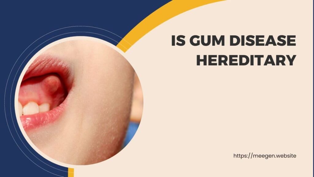 Is gum disease hereditary