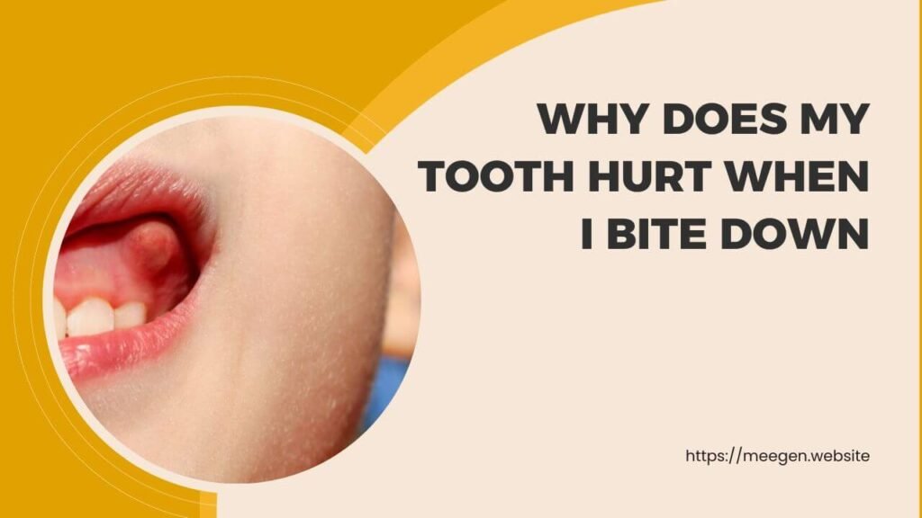 Why does my tooth hurt when i bite down 
